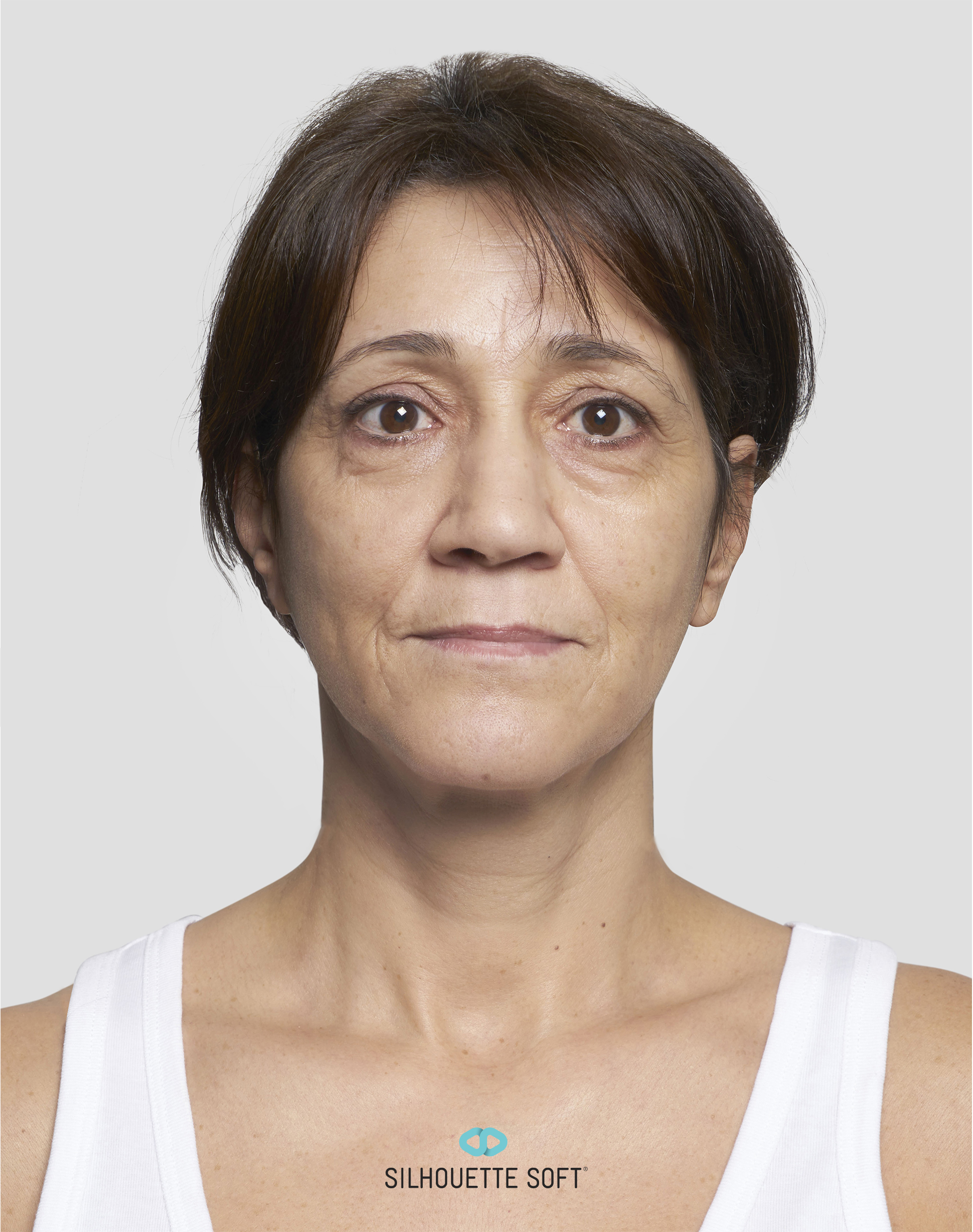 Silhouette Soft® - Bild 01 - Praxis Dr. Raab München