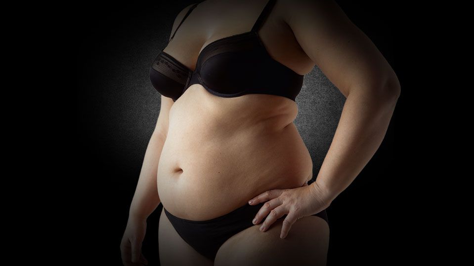 Vaser® Lipo | Ultraschall Fettabsaugung mit Straffungseffekt