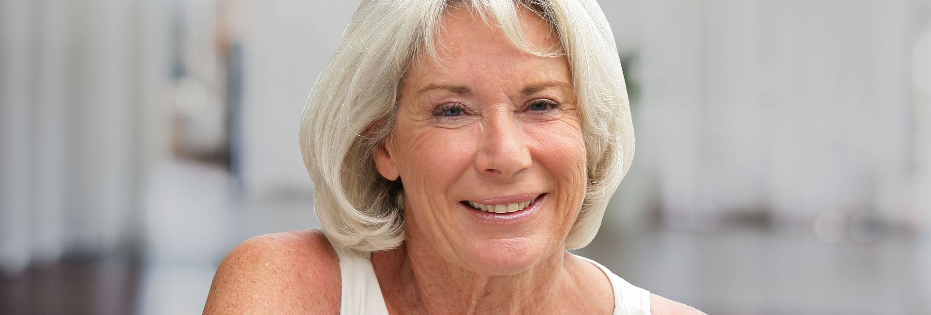 Faltenbehandlung München - Frau/Weiblich - 50 Jahre 