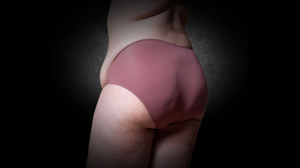 Argon Plasma | Hautstraffungsmethode | Dr. Raab