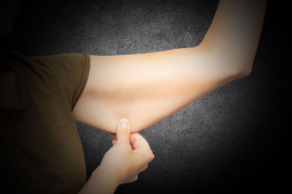 Schlaffe Oberarme nach Schwangerschaft