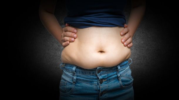 Schlaffe Haut am Bauch nach Schwangerschaft