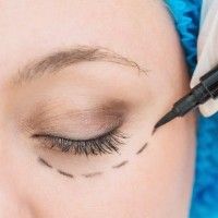 Eyelid tightening Munich