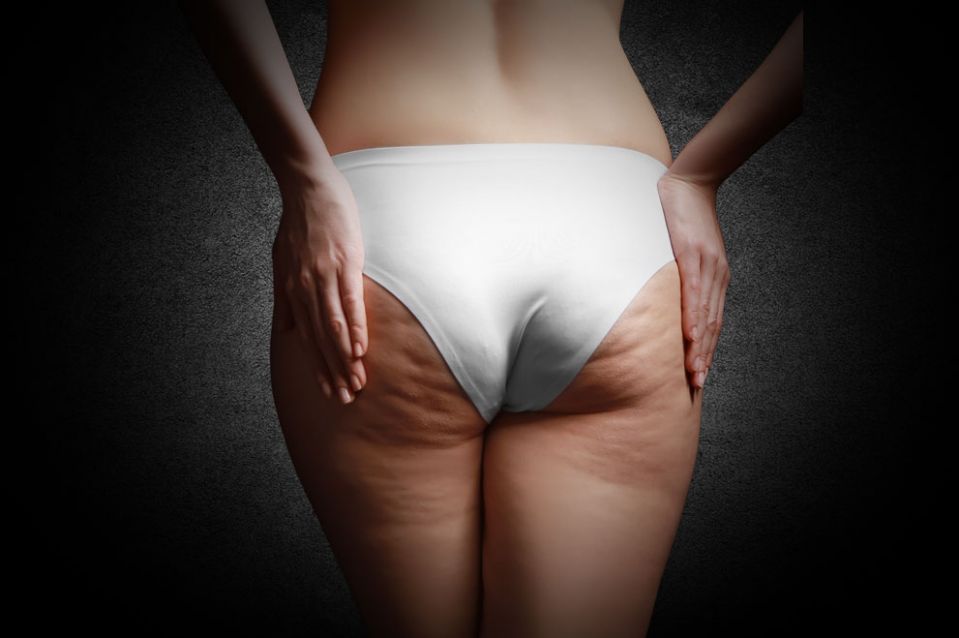 Schlaffer Po nach Schwangerschaft